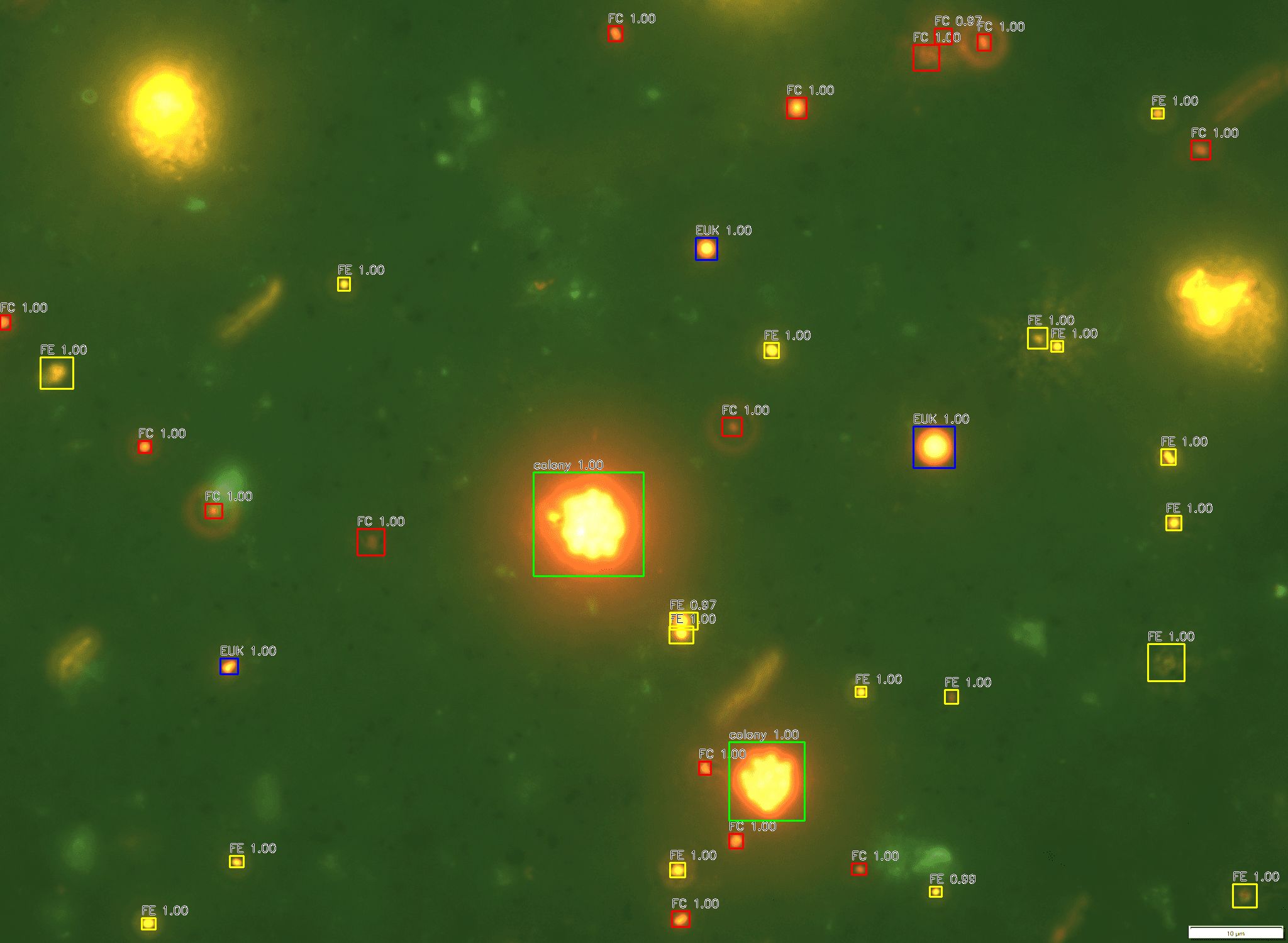 Example pico-algae detection overlay.